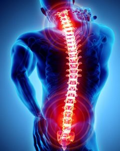 Medial Branch Nerve Block Injections