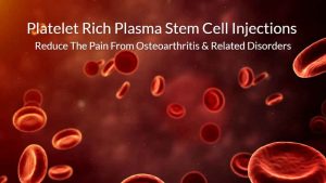 platelet-rich plasma therapy