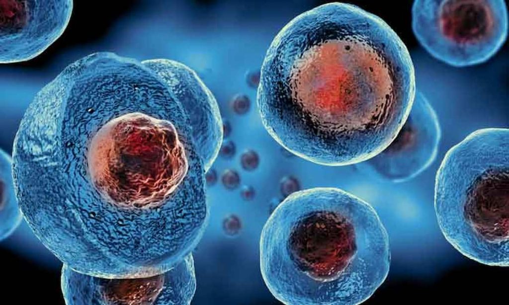 Umbilical Cord Stem Cell Therapy