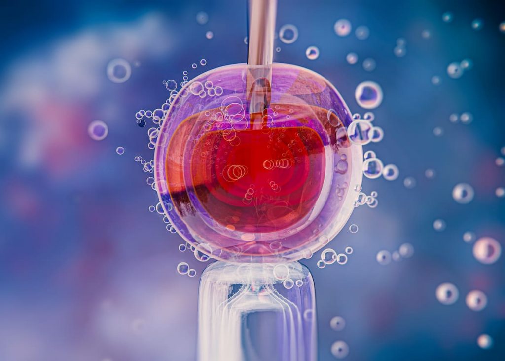Umbilical Cord StemCell Injections