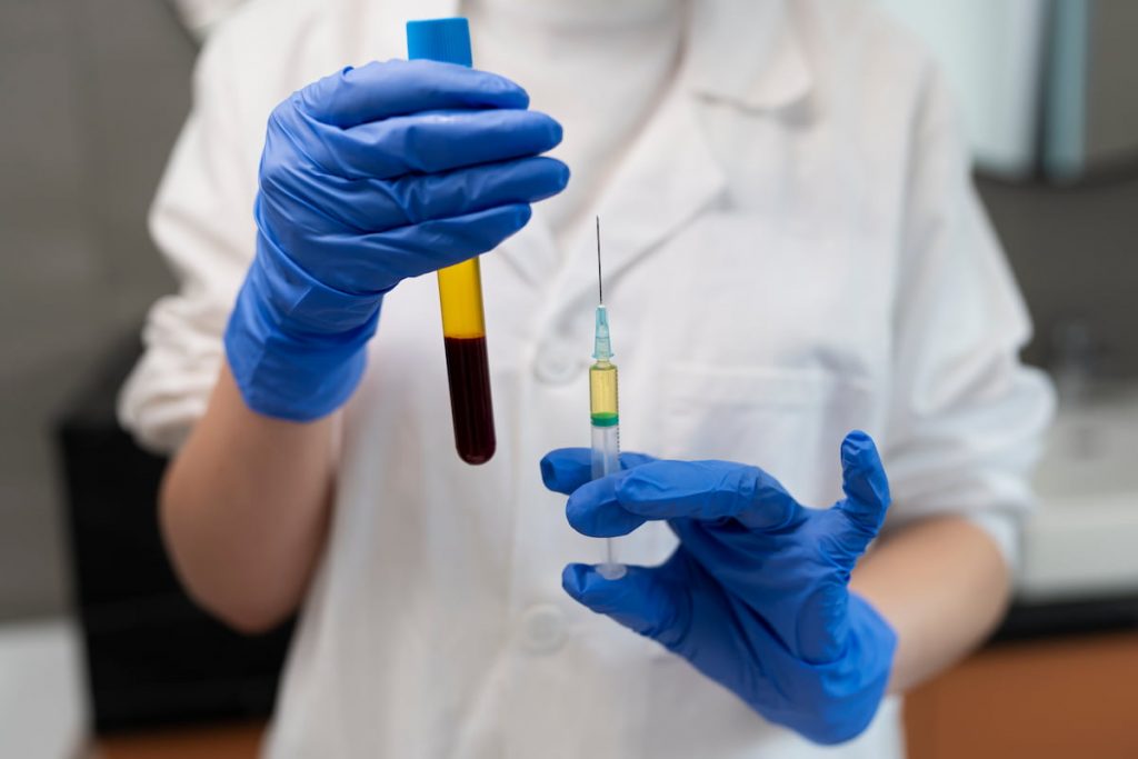 PRP Therapy Boosts Recovery