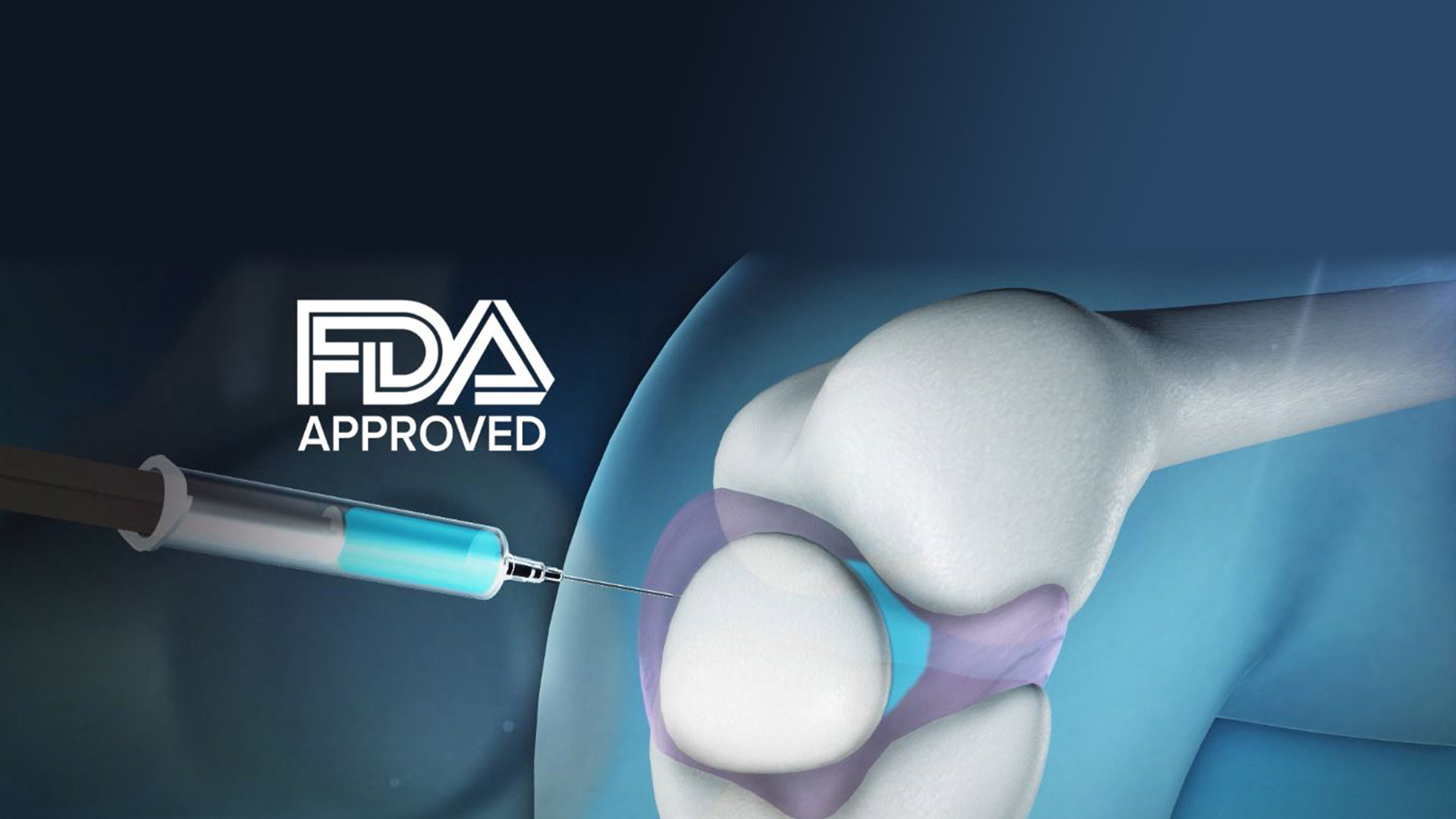 Viscosupplementation Knee Therapy 2 pain relief pain relief,interventional pain management,interventional pain management center,Regenerative medicine in Hazlet NJ