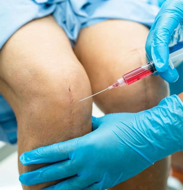 asian doctor inject hyaluronic acid platelet rich plasma into knee senior woman walk without pain 2 6 Prolotherapy Prolotherapy,Prolotherapy near me,regenerative medicine near me,regenerative medicine in hazlet nj