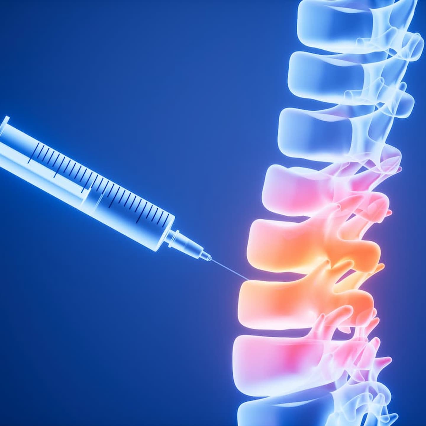 inflammation human spine drug therapy medical concept 3d rendering 1 1 1 Interventional pain management treatments Interventional pain management treatments,regenerative medicine,stem cell treatment,Regenerative medicine in Hazlet NJ,interventional therapy near me